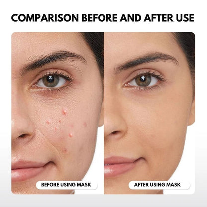 LED Infrared Therapy Mask with Remote