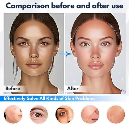 LED Infrared Therapy Mask with Remote